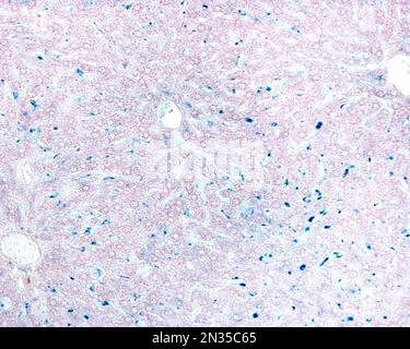 Le cellule epatiche di Kupffer sono macrofagi correlati alle sinusoidi epatiche. Quando le cellule di Kupffer fagocitano il blu di Trypan circolante, una macchia vitale che può b Foto Stock