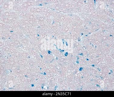 Le cellule epatiche di Kupffer sono macrofagi correlati alle sinusoidi epatiche. Quando le cellule di Kupffer fagocitano il blu di Trypan circolante, una macchia vitale che può b Foto Stock
