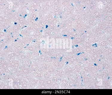 Le cellule epatiche di Kupffer sono macrofagi correlati alle sinusoidi epatiche. Quando le cellule di Kupffer fagocitano il blu di Trypan circolante, una macchia vitale che può b Foto Stock