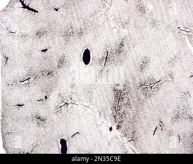 Lo studio di una microvascolatura d'organo implica di solito il riempimento dei vasi sanguigni con un'etichetta visibile al microscopio. Micro a basso ingrandimento Foto Stock