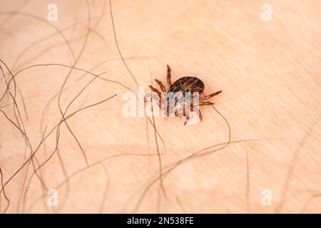 Un insetto che succhia sangue pericoloso. Piccolo acaro marrone macchiato, nome biologico Dermacentor reticulatus sulla pelle umana Foto Stock