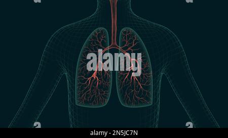 Malattia polmonare 3D ha reso illustrazioni. Il processo di infiammazione polmonare durante polmonite, infezione da virus, raffreddore, asma, allergie, covid Foto Stock