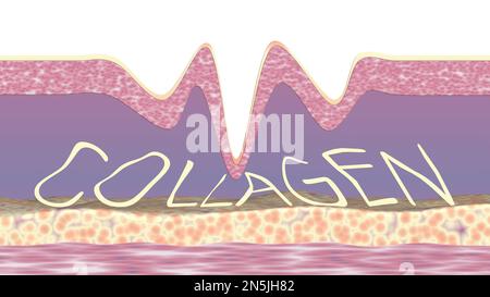 Distruzione delle fibre di collagene in pelle rugosa invecchiamento concettuale 3D resa illustrazione Foto Stock