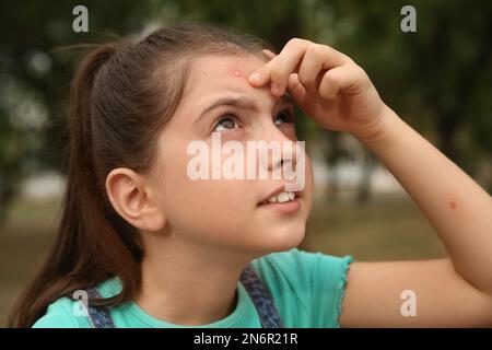 Ragazza graffiare la fronte con morso di insetto nel parco Foto Stock