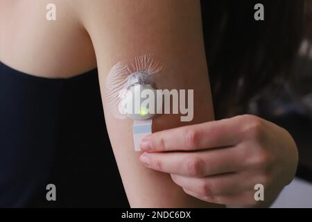 Inserito sensore glicemia con trasmettitore e adesivo adesivo Foto Stock