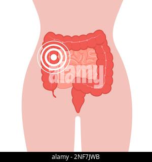 Dolore intestinale. Malattie del colon. Cancro degli organi interni. Illustrazione vettoriale medica in stile cartoon piatto Illustrazione Vettoriale