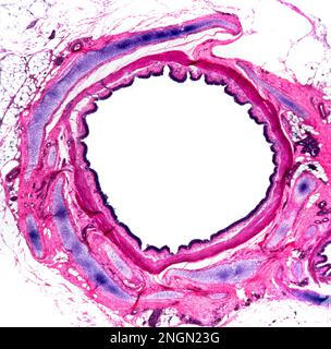 Sezione brochal umana, i bronchi sono le vie aeree che portano dalla trachea nei polmoni Foto Stock