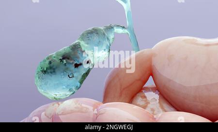 Calcoli biliari nel dotto biliare gallbladderand, silhouette umana e anatomia degli organi circostanti, fegato e cistifellea con pietre, rendering 3D realistico Foto Stock