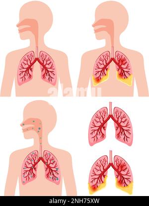 Illustrazione della raccolta delle icone dei polmoni umani Illustrazione Vettoriale