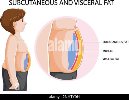 Illustrazione del diagramma del grasso sottocutaneo e viscerale Illustrazione Vettoriale
