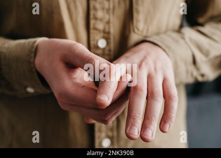 Primo piano di un giovane uomo caucasico malsano affetto da artrite nelle dita. Causa di dolore includono artrite reumatoide, sindrome del tunnel carpale, tri Foto Stock