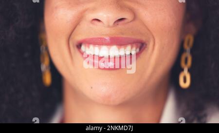 Igiene orale primo piano di una donna sorridente e che mostra i suoi denti bianchi perfetti. Giovane donna nera sicura con un sorriso impeccabile e bello. Visita Foto Stock