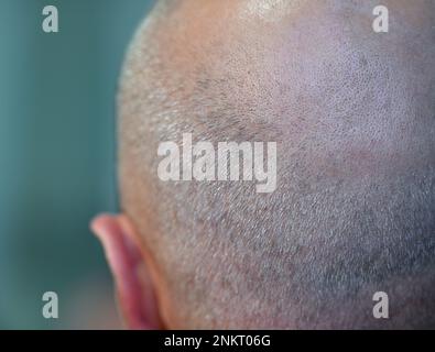 Spreetal, Germania. 22nd Feb, 2023. Un uomo con una testa mezza calva. Credit: Patrick Pleul/dpa/Alamy Live News Foto Stock