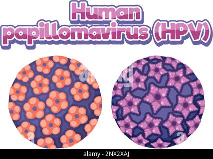 Papillomavirus umano (HPV) su illustrazione di sfondo bianco Illustrazione Vettoriale