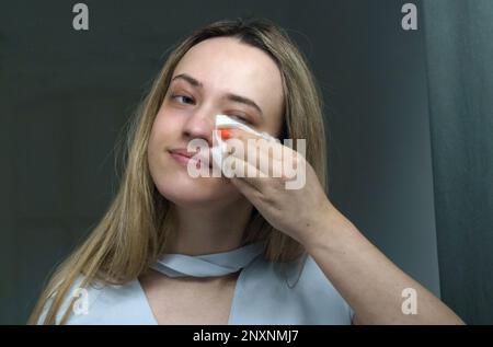 Giovane donna pulisce il suo volto con tovaglioli. Primo piano Foto Stock