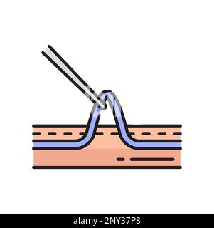 Chirurgia scleroterapica, iniezione di soluzione in vena attraverso catetere isolato icona contorno. Trattamento varicoso vettore e vene ragno procedura medica Illustrazione Vettoriale