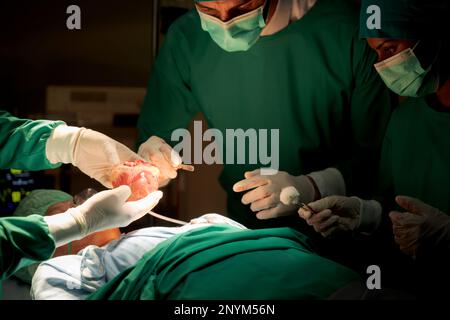 Team medici sala operatoria vestiti uniformi verdi salvando vite criticamente paziente sottoposto a chirurgia cardiaca per i pazienti di cuore vi standardizzato surg Foto Stock