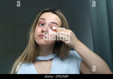 Una giovane donna pulisce le palpebre con tovaglioli. Primo piano Foto Stock