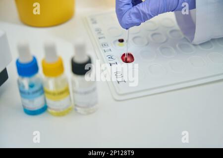 L'ematologo lavora con i campioni di sangue su una tavolozza di indicazioni Foto Stock