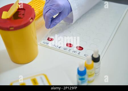 L'assistente di laboratorio lavora con i campioni di sangue su una tavolozza di indicazioni Foto Stock