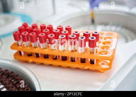 Rack di provette per sangue con etichette con codice a barre per una corretta identificazione Foto Stock