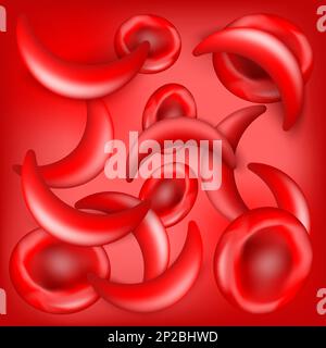 Malattia a cellule falciformi. SCD. Eritrociti normali e cellule falciformi nel flusso sanguigno. sfondo rosso. Anemia o anemia. disturbi del sangue. Poster vettoriale Illustrazione Vettoriale