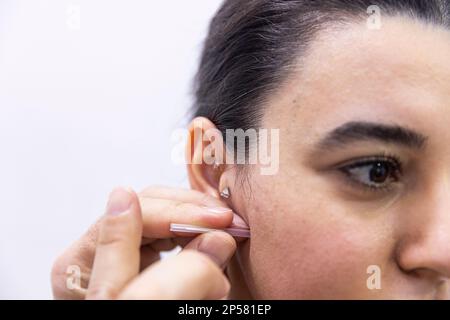 Trattamento dell'ago a secco. Un ritratto di un piccolo ago di agopuntura che si attacca nel viso di una persona accanto al naso, per guarire il dolore, alleviare lo stress o un altro m. Foto Stock