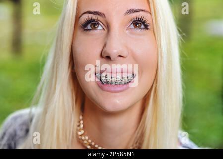 In questo ritratto di una ragazza sorridente, le due file di denti con bretelle sono perfettamente visibili. Sta guardando in su oltre l'obiettivo e le bretelle sono il Foto Stock