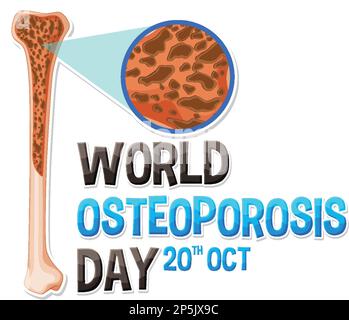 Giornata mondiale dell'osteoporosi nel mese di ottobre illustrazione Illustrazione Vettoriale