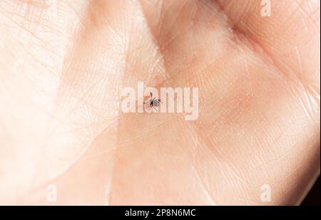 Un tick animale su una mano umana Foto Stock