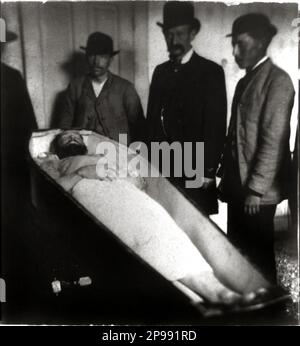1882 : il fuorilegge occidentale JESSE JAMES ( Jesse Woodson James 1847 - 1882 ) post mortem . Foto di R. Uhlman , St. Joseph , Missouri - Selvaggio WEST - epopea del - FUORILEGGE - bandito - mortone - cadavera - morto - cadavere - corpo - post mortem - cravatta - barba - barba - barba - bara - bara - bara ---- Archivio GBB Foto Stock