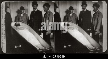 1882 : il fuorilegge occidentale JESSE JAMES ( Jesse Woodson James 1847 - 1882 ) post mortem . Foto stereografica di R. Uhlman , St.. Joseph , Missouri - Selvaggio WEST - epopea del - FUORILEGGE - bandito - morto - cadavera - corpo - post mortem - cravatta - barba - barba - barba - barba - bara - bara - STEREOGRAFIA - 3D --- Archivio GBB Foto Stock