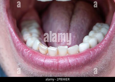 Maschio caucasico a bocca aperta che mostra una fila di denti bianchi e la parte posteriore della gola. Primo piano scatto macro, volto irriconoscibile. Foto Stock