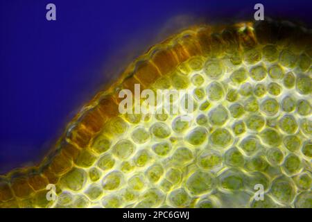 Vista microscopica della sezione trasversale dello stelo della forsite di bordo (Forsythia x intermedia). Luce polarizzata con polarizzatori incrociati. Foto Stock