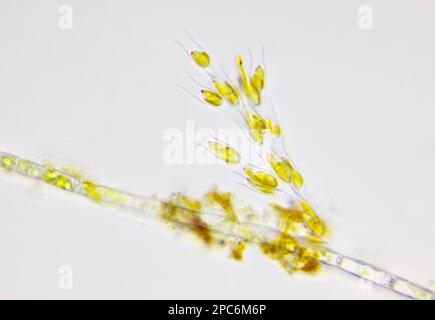 Vista microscopica della colonia di alghe (Dinobryon) sul filamento di alghe verdi. Illuminazione a campo chiaro. Foto Stock