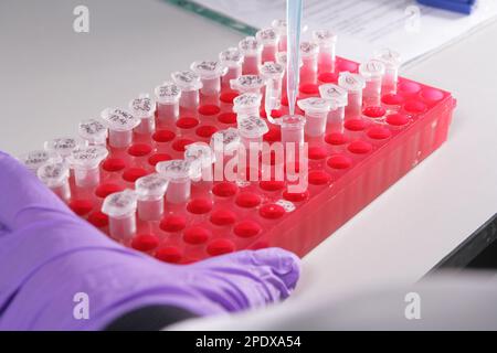 Primo piano delle provette in laboratorio con pipetta, Foto Stock