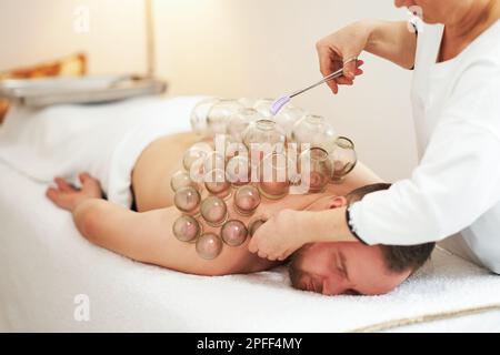 Un'immagine di un uomo che ha la terapia di cupping Foto Stock