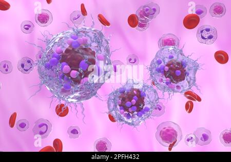 Cellule tumorali neuroendocrine metastatiche nel flusso sanguigno - 3D illustrazione vista isometrica Foto Stock