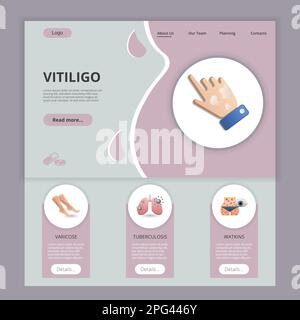 Modello di sito web della landing page piatta di Vitiligo. Varicose, tubercolosi, watkins. Banner Web con intestazione, contenuto e piè di pagina. Illustrazione vettoriale. Illustrazione Vettoriale