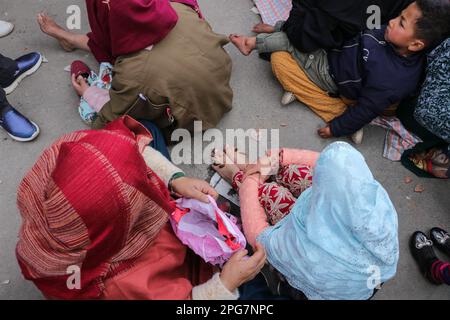 21 marzo 2023, Srinagar, Jammu e Kashmir, India: Le persone ricevono un trattamento di leche sulla riva del lago dal a Srinagar. Ogni anno il 21st marzo di Nowroz, gli operatori sanitari tradizionali in Kashmir usano le sanguisughe per trattare le persone che hanno prurito, grumi dolorosi sulla loro pelle chiamati chilblains che si sviluppano durante l'inverno. La Leech Therapy è una lunga procedura praticata nella medicina tradizionale perso-araba di Unani, che è praticata nella cultura musulmana in Asia del Sud così come nell'Asia Centrale moderna. (Credit Image: © Adel Abbas/ZUMA Press Wire) SOLO PER USO EDITORIALE! Non per USO commerciale! Foto Stock