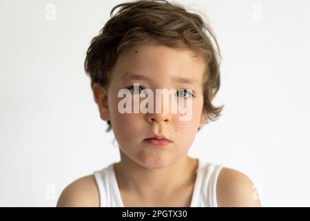 Il ragazzo era gonfio dalle allergie. Allergia da polline o cibo. Foto Stock