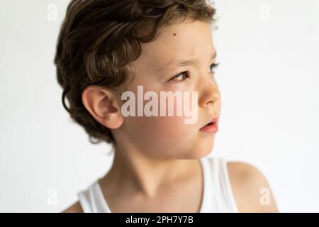 Il ragazzo era gonfio dalle allergie. Allergia da polline o cibo. Foto Stock