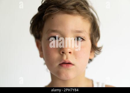 Il ragazzo era gonfio dalle allergie. Allergia da polline o cibo. Foto Stock