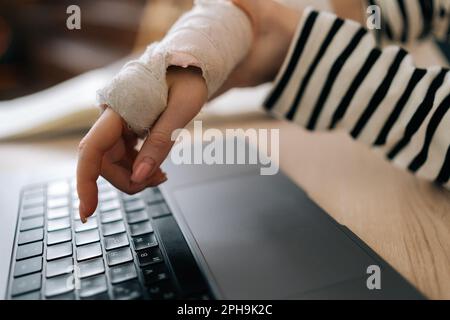 Primo piano ripresa ritagliata di una giovane donna inriconoscibile infortunata con la mano destra rotta avvolta in bendaggio di gesso bianco che lavora digitando sul notebook Foto Stock