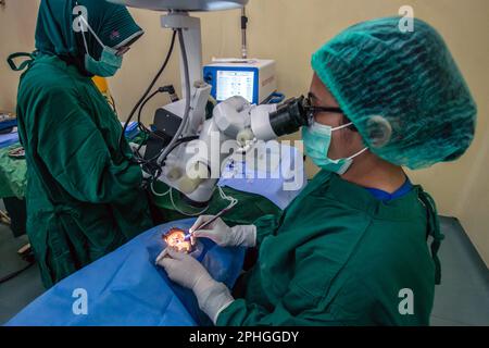 BOGOR, INDONESIA - 27 marzo 2023: I medici effettuano la chirurgia dell'occhio di cataratta sui pazienti usando la tecnica di facoemulsificazione a Bogor, Indonesia Foto Stock
