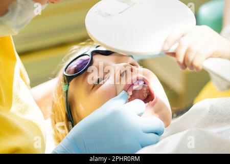 Placca sui denti di colore rosa e viola.collutorio per bambini. Visita dentale. Denti prima e dopo la spazzolatura e lo sbiancamento in una foto. Preventivo Foto Stock