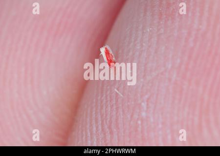 Scheggia il dito. Un pezzo di legno appuntito e piccolo che si inserisce nella pelle del dito, del sangue, del sanguinamento. Foto Stock