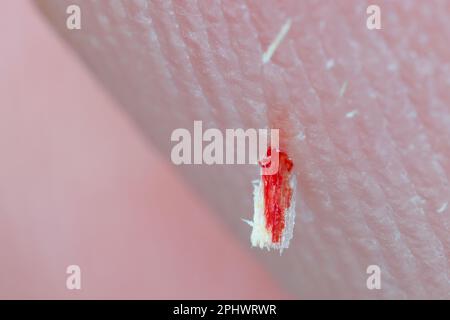 Scheggia il dito. Un pezzo di legno appuntito e piccolo che si inserisce nella pelle del dito, del sangue, del sanguinamento. Foto Stock