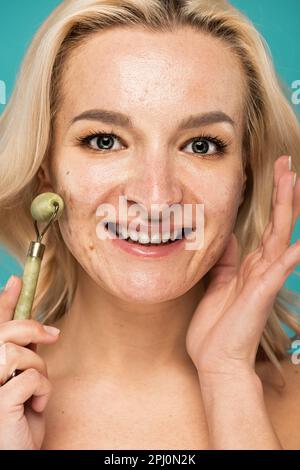 primo piano di donna allegra bionda con rullo di giada di tenuta acne isolato sul turchese, immagine di scorta Foto Stock