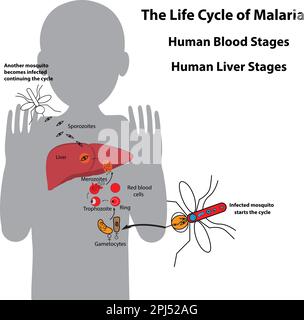 Ciclo di vita del parassita della malaria, stadi del sangue umano e stadi del fegato umano Illustrazione Vettoriale